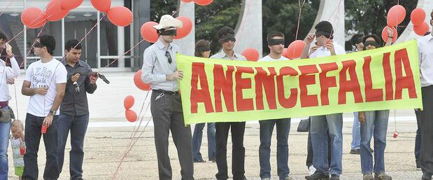 O STF e a antecipação do parto de anencéfalos